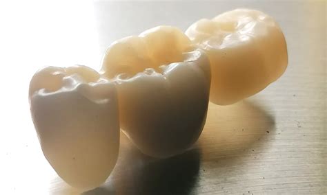  Zirconia: Un Materiale Ceramico Innovativo per Applicazioni di Alta Temperatura!